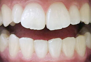 段階を踏んだ自然な白さ